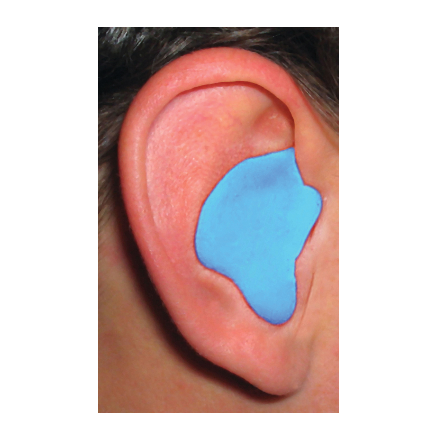 Radians® CEP001-B TCN CEP001-B