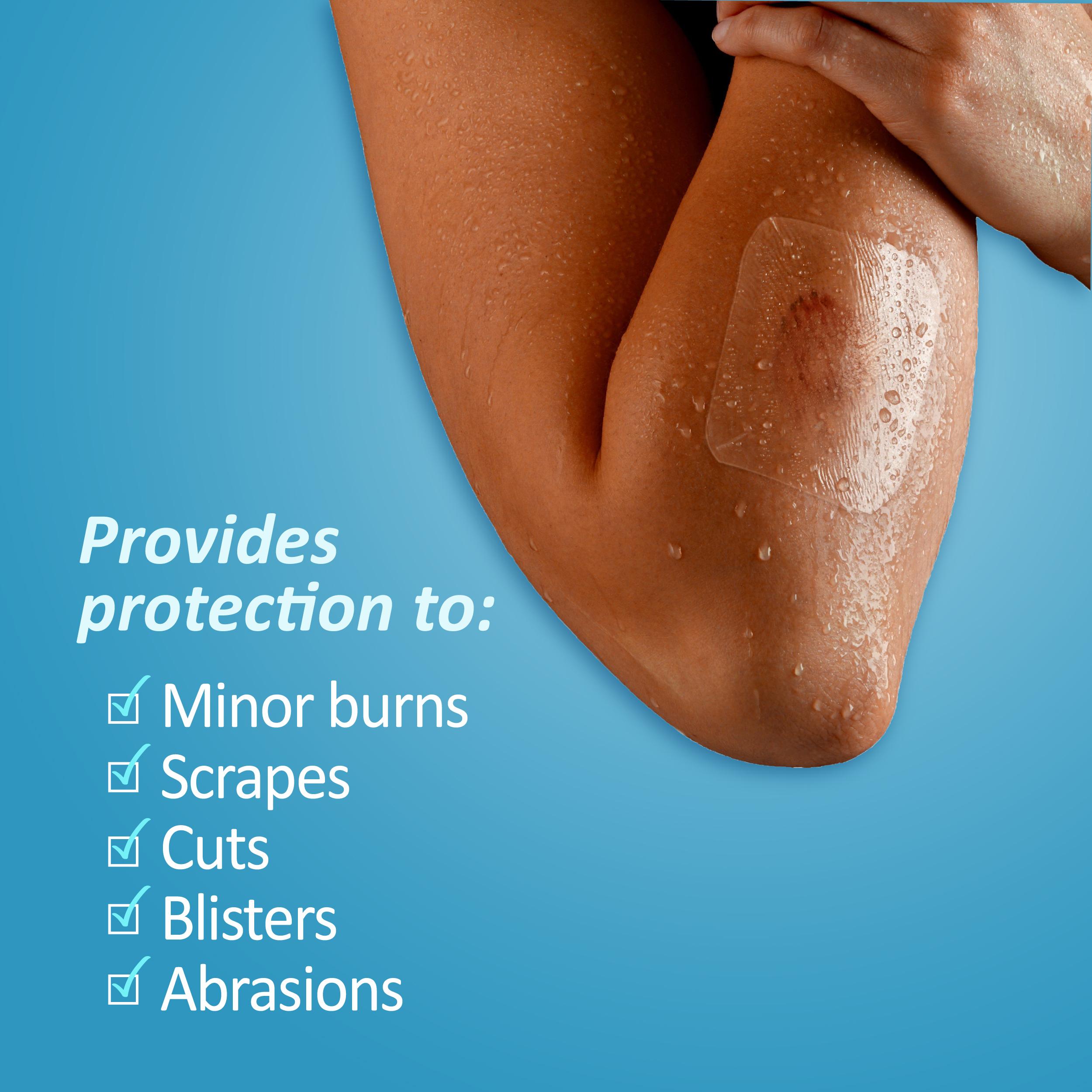 Nexcare&trade; 7000047833 MMMR-64113